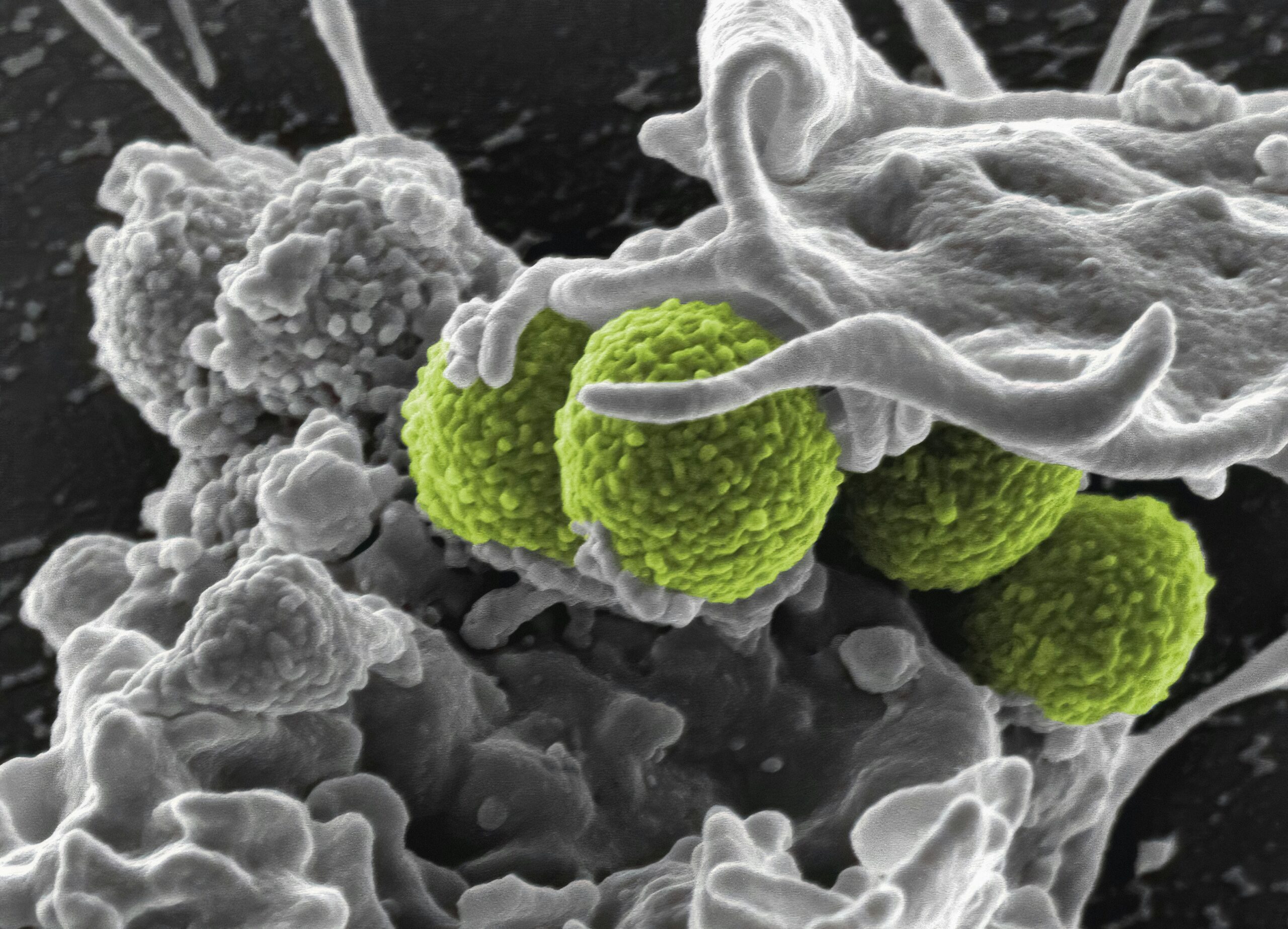 Scanning electron micrograph of methicillin-resistant Staphylococcus aureus (MRSA) bacteria